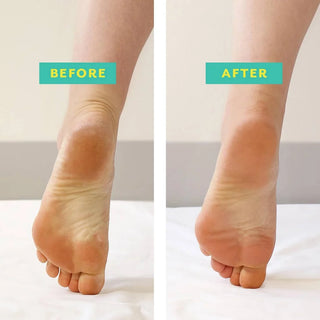 Mistletoes Foot Repair Kit